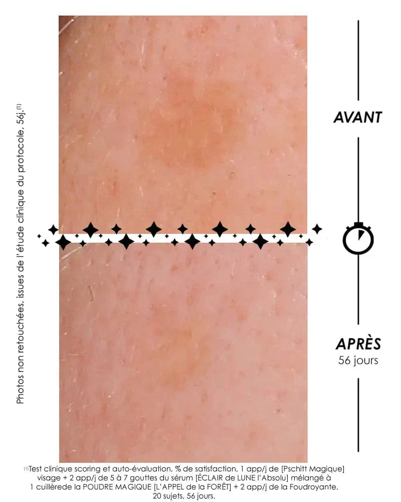[ RITUEL CORRECTION ANTI-TACHES ]